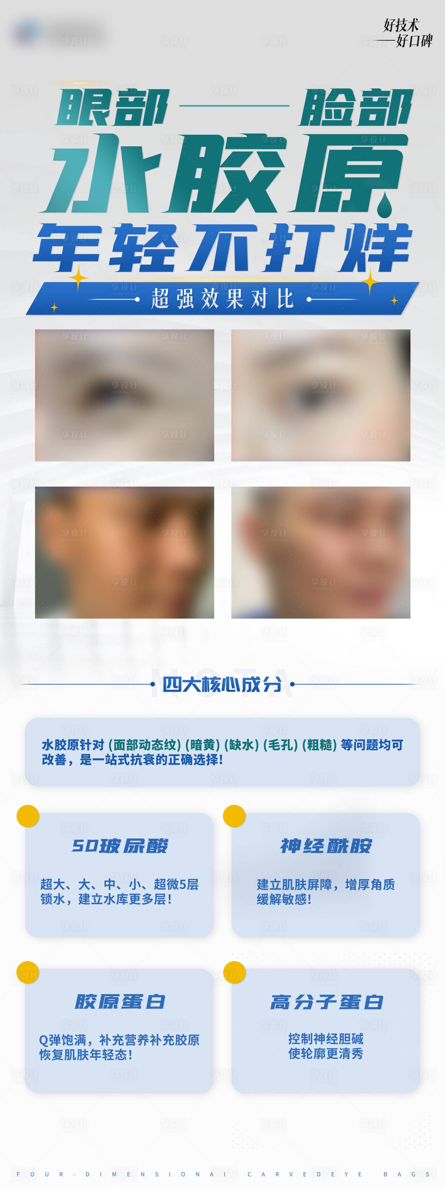 源文件下载【水光针易拉宝】编号：10200008851642970
