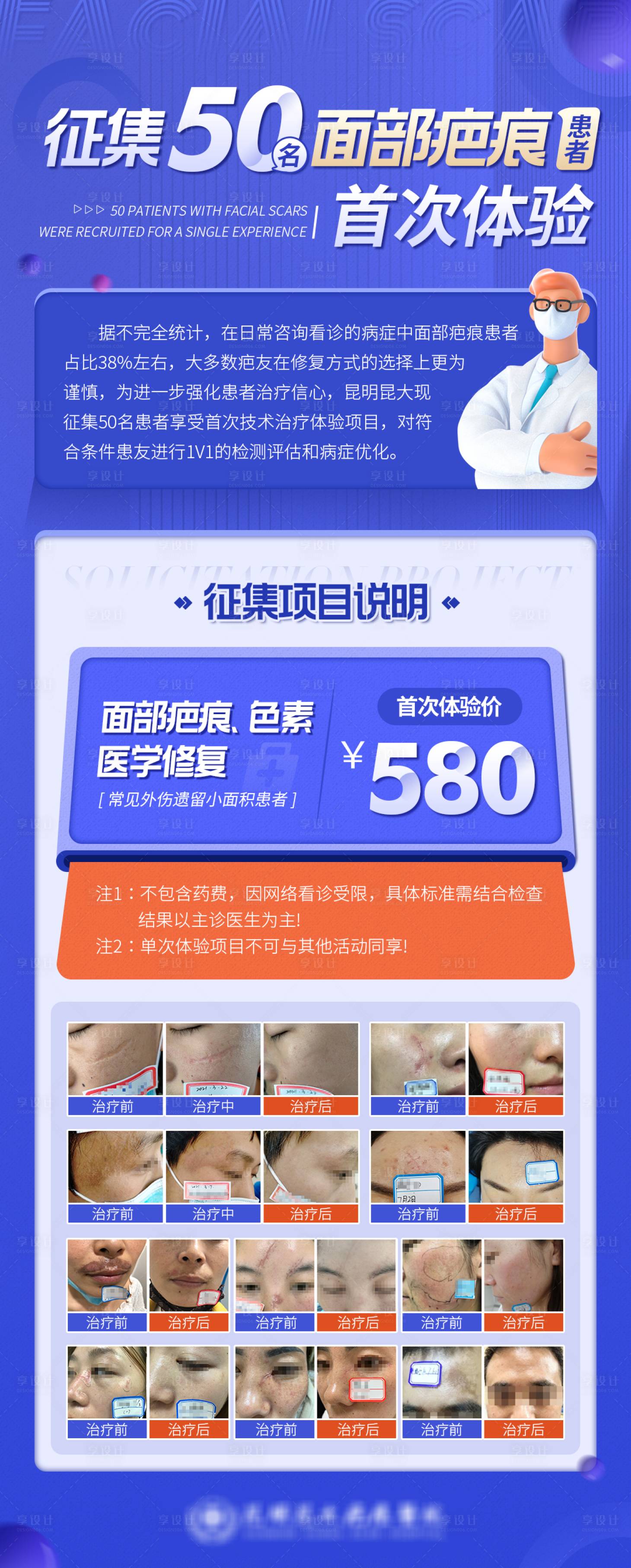 源文件下載【享設計】搜索編號：80650009105876664【醫療征集50名面部疤痕患者首次體驗】