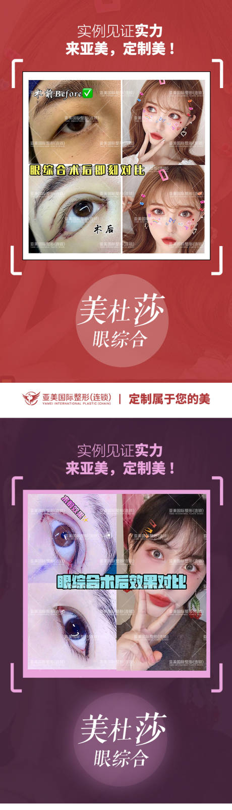源文件下载【医美整形案例对比系列海报】编号：13060009155012143