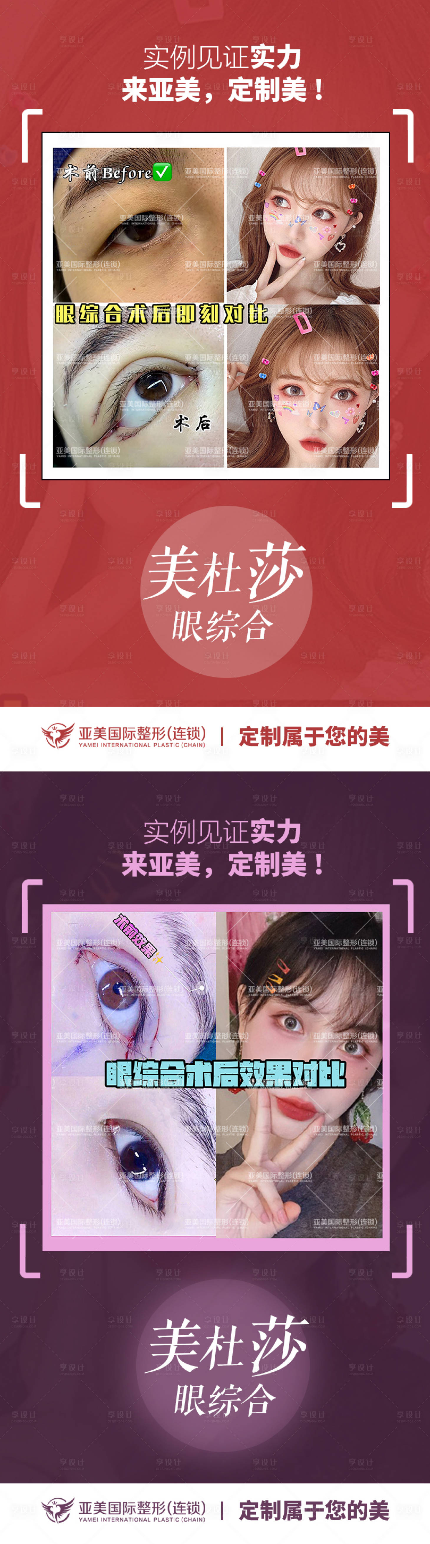 源文件下載【享設計】搜索編號：13060009155012143【醫美整形案例對比系列海報】