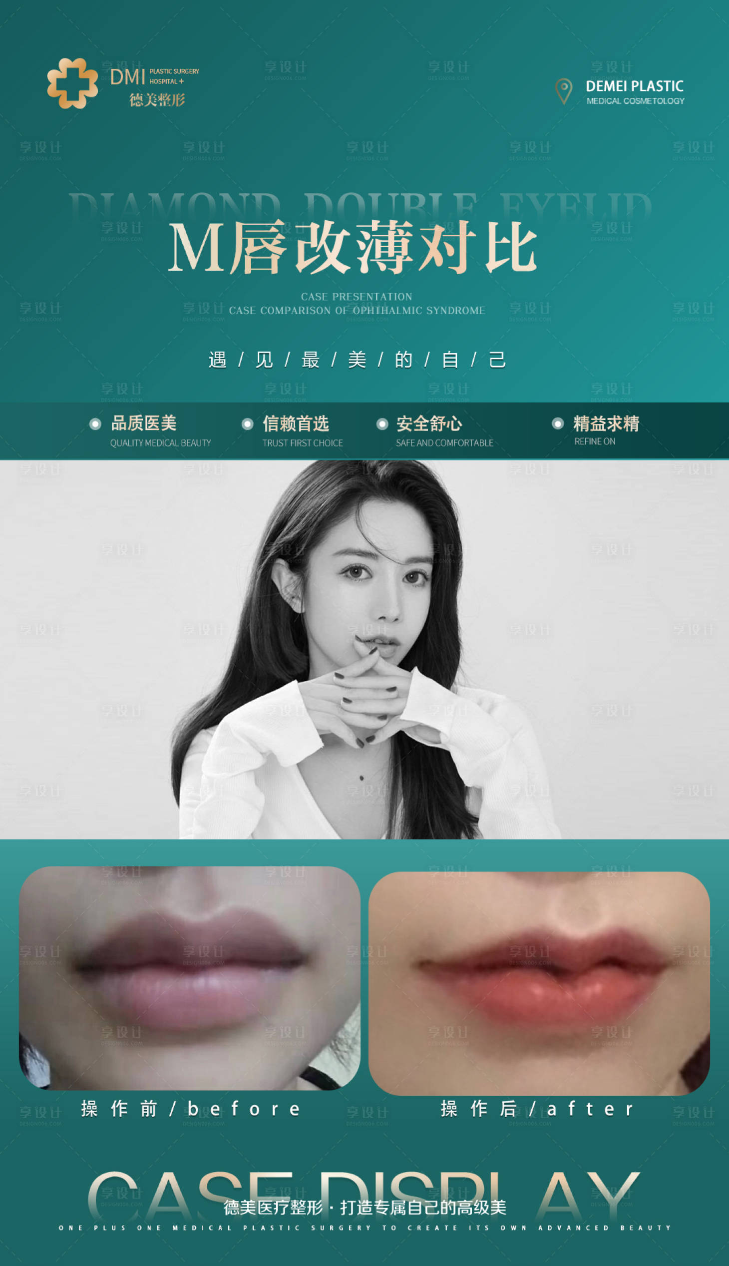 源文件下載【醫美案例整形對比海報】編號：12000008734269738