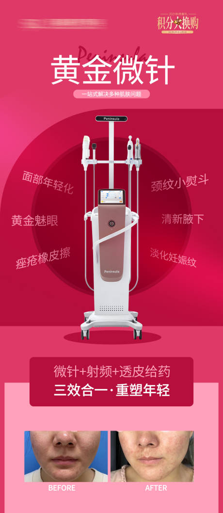 源文件下载【医美黄金微针海报】编号：25230008793372748