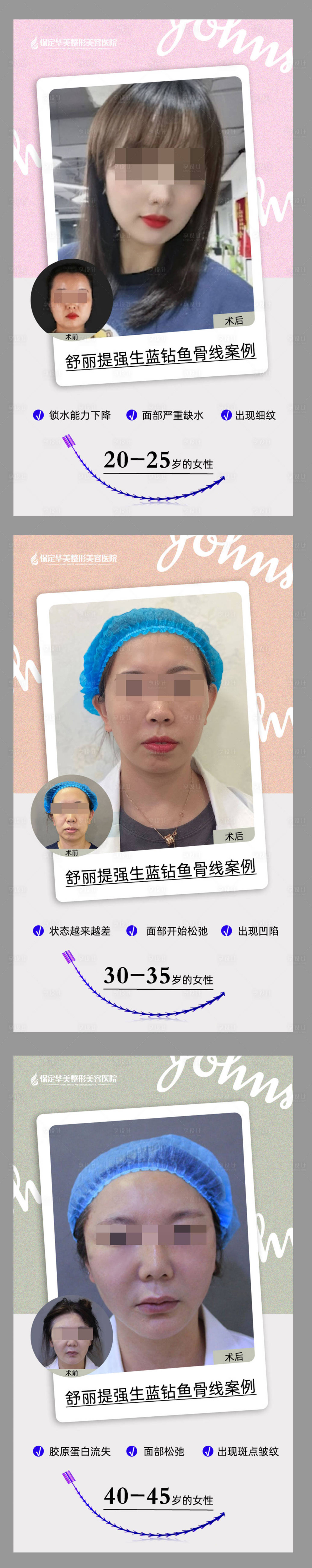 源文件下載【享設計】搜索編號：94840008746241343【舒立提強生藍鉆魚骨線】