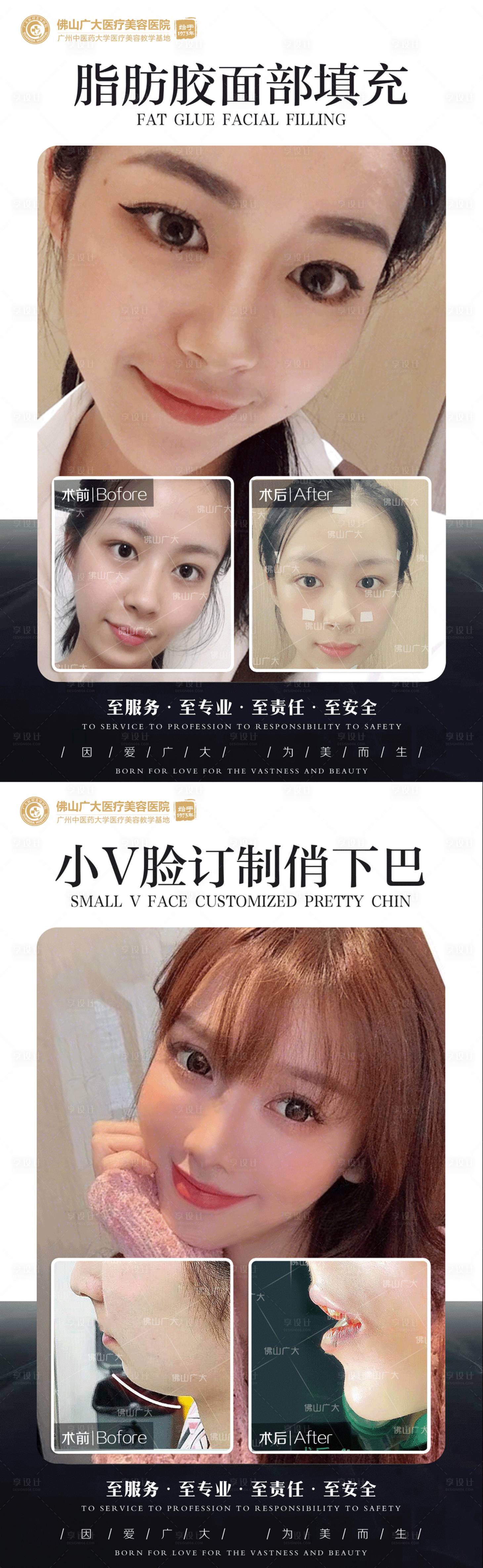 源文件下载【享设计】搜索编号：91240009016563629【整形真人案例分享集】