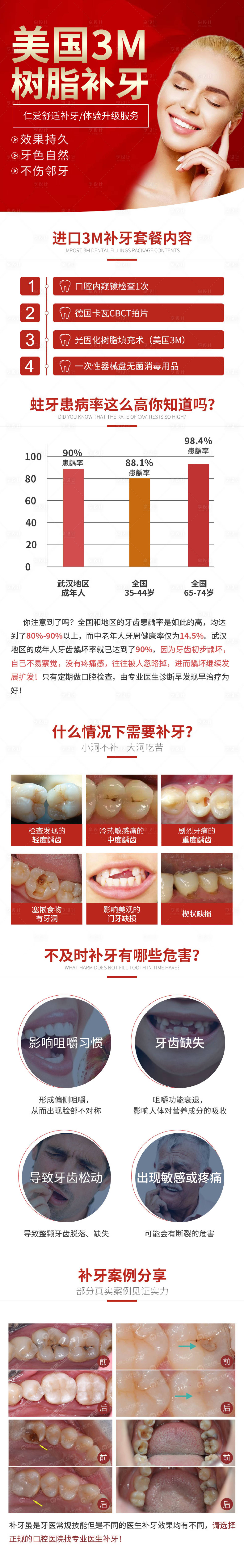 源文件下載【享設計】搜索編號：27530008974809315【美國3M補牙詳情】