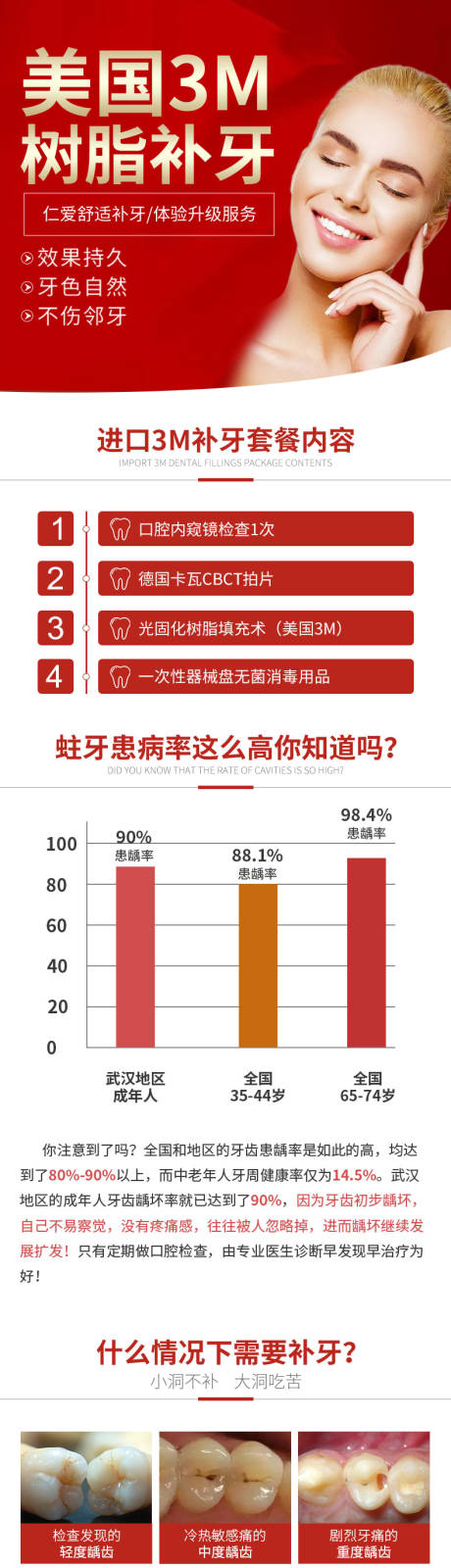 美国3M补牙详情