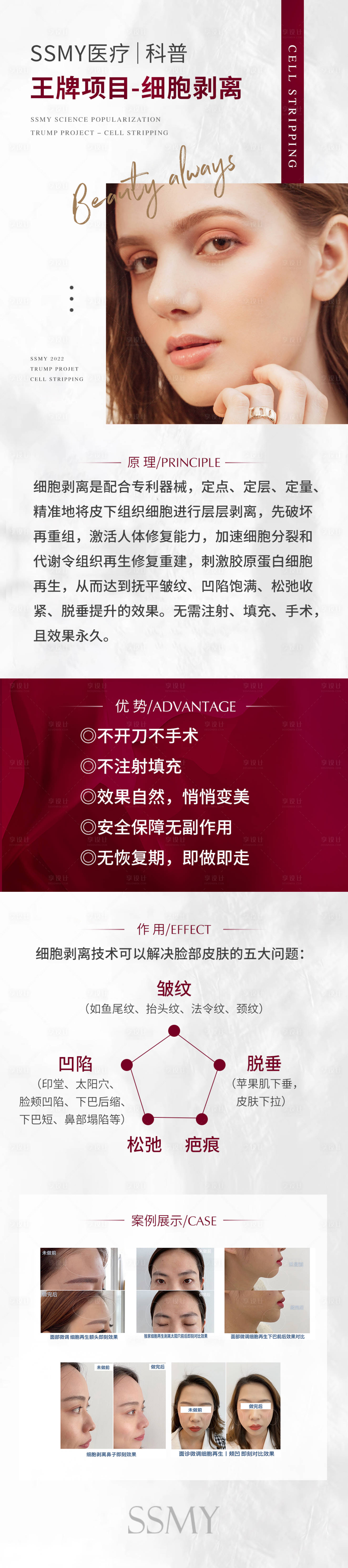 源文件下載【享設(shè)計(jì)】搜索編號(hào)：53630009019001260【醫(yī)美細(xì)胞剝離項(xiàng)目科普】