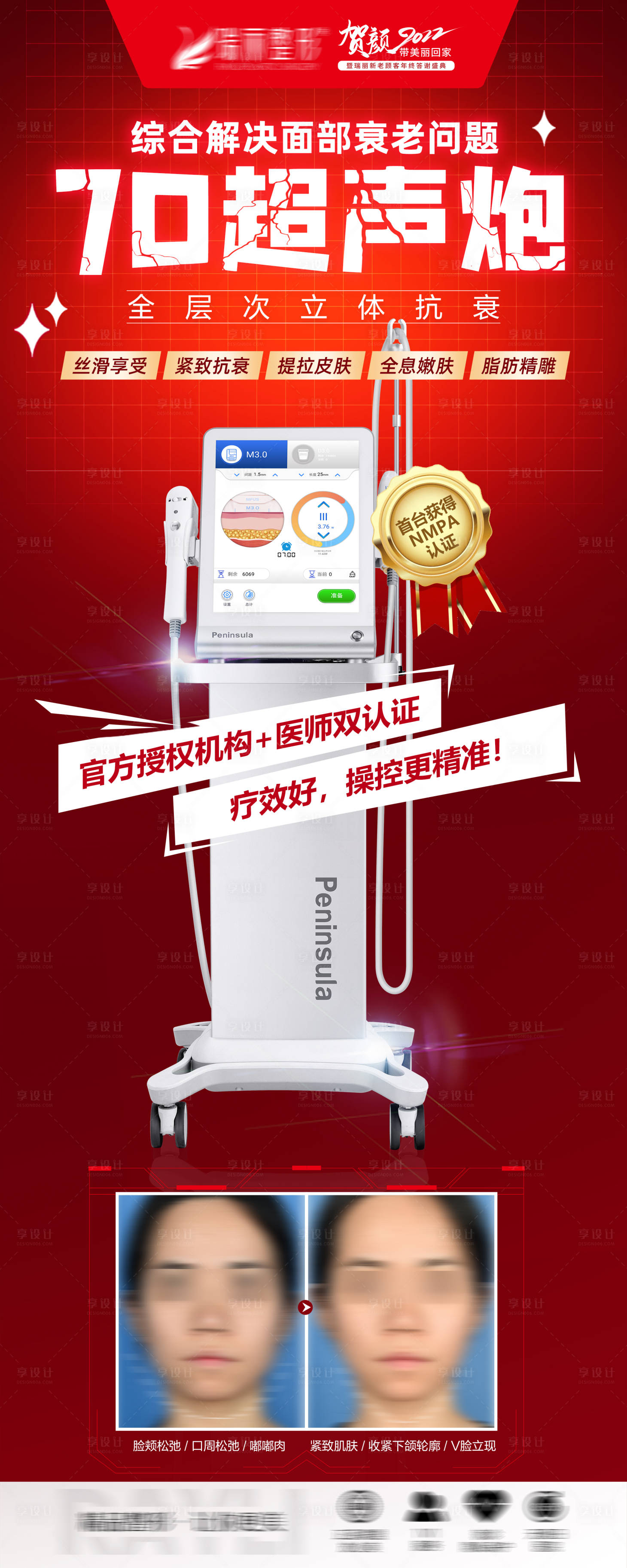 源文件下載【享設計】搜索編號：69180008827099017【醫美超聲炮】