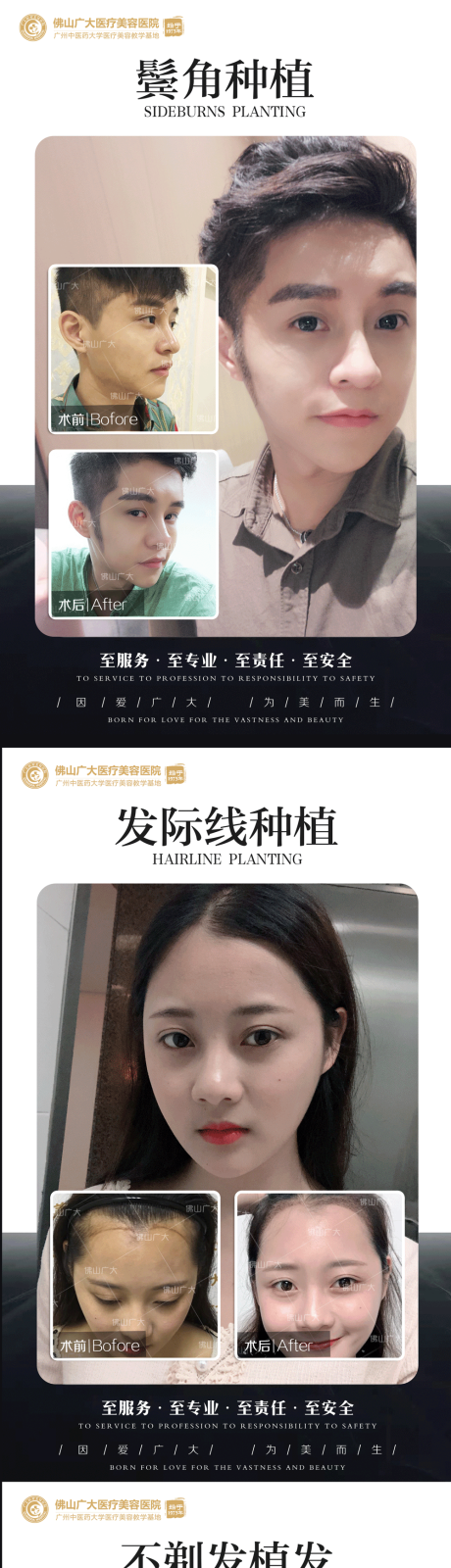 源文件下载【植发真人案例分享集】编号：91990009016013146