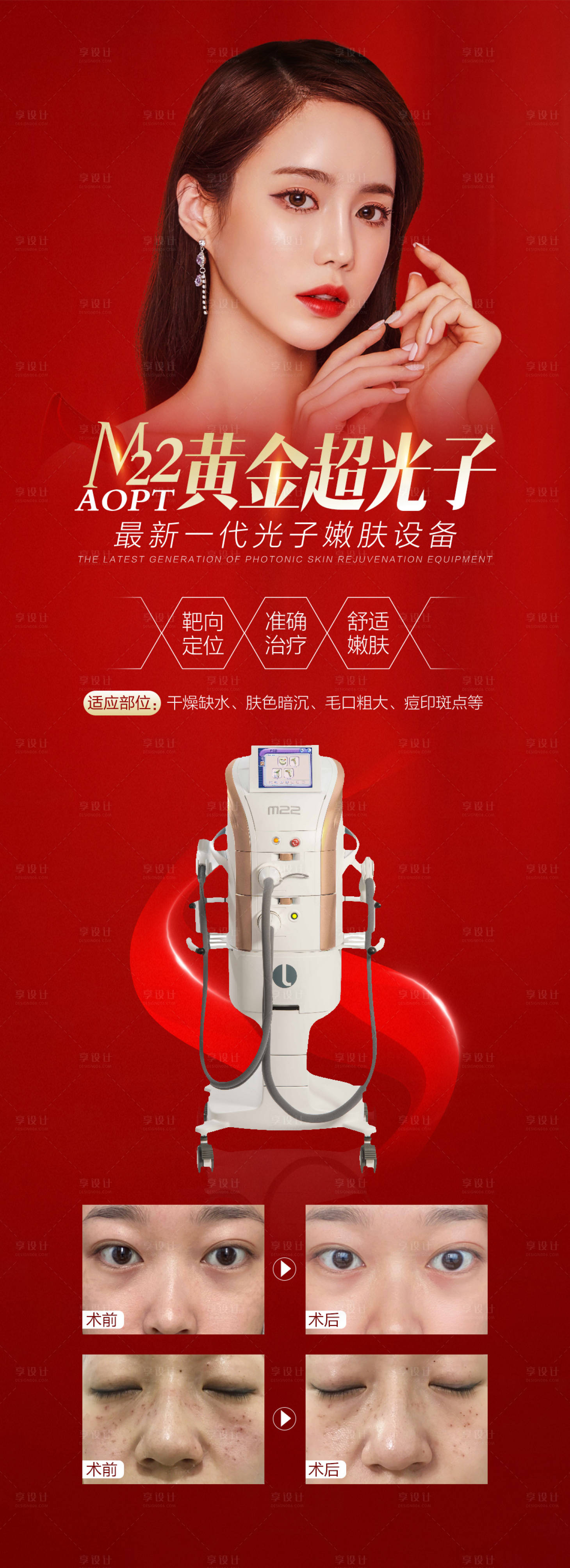 源文件下載【享設(shè)計(jì)】搜索編號(hào)：83630008982118495【醫(yī)美黃金超光子長(zhǎng)圖海報(bào)】
