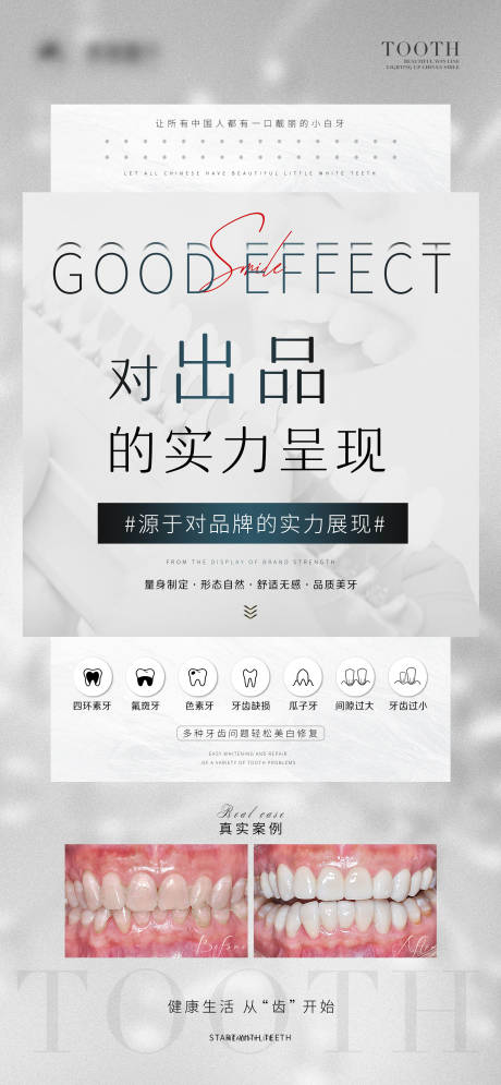 源文件下载【牙科贴面海报】编号：18630009099167795