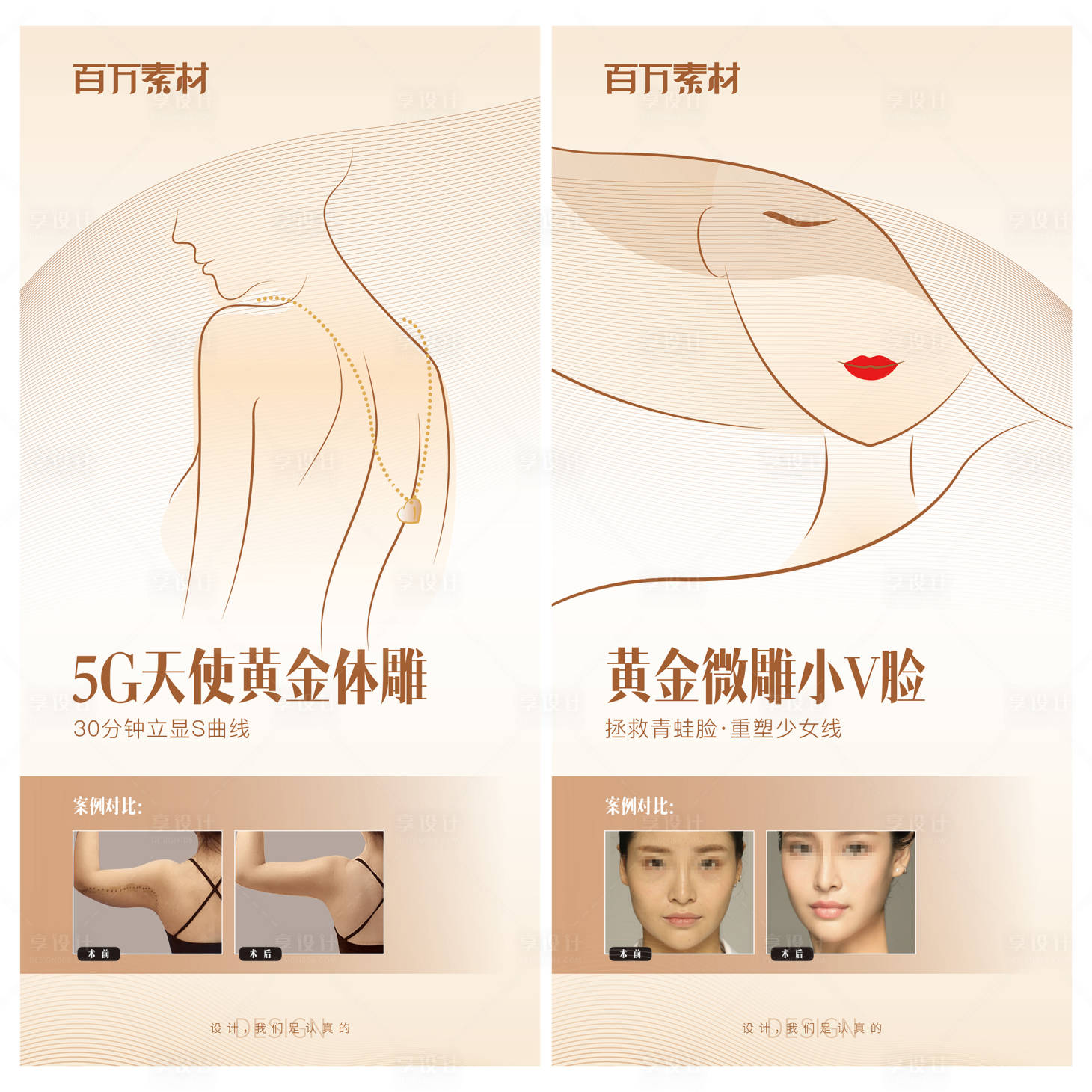 源文件下载【享设计】搜索编号：28350008991331189【医美案例海报】