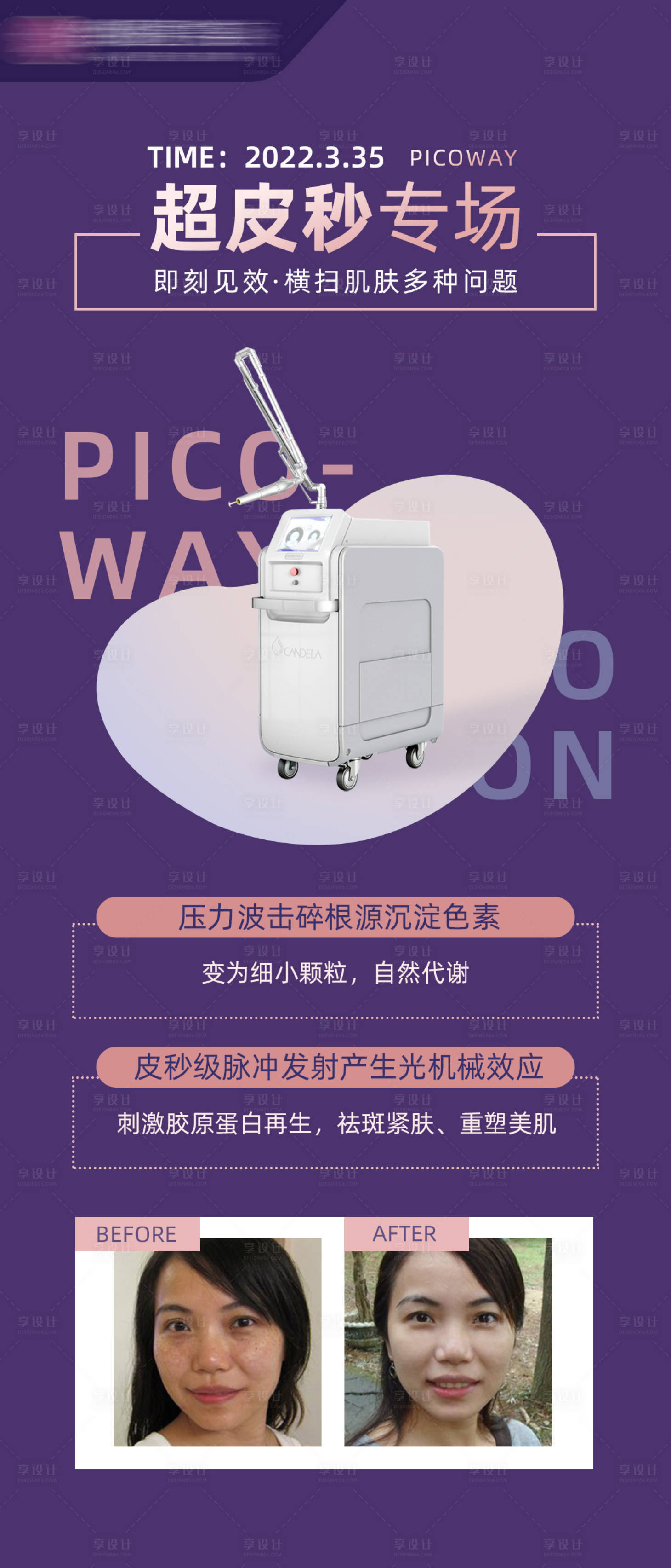 源文件下載【享設計】搜索編號：85510009063029407【醫美超皮秒專場海報】
