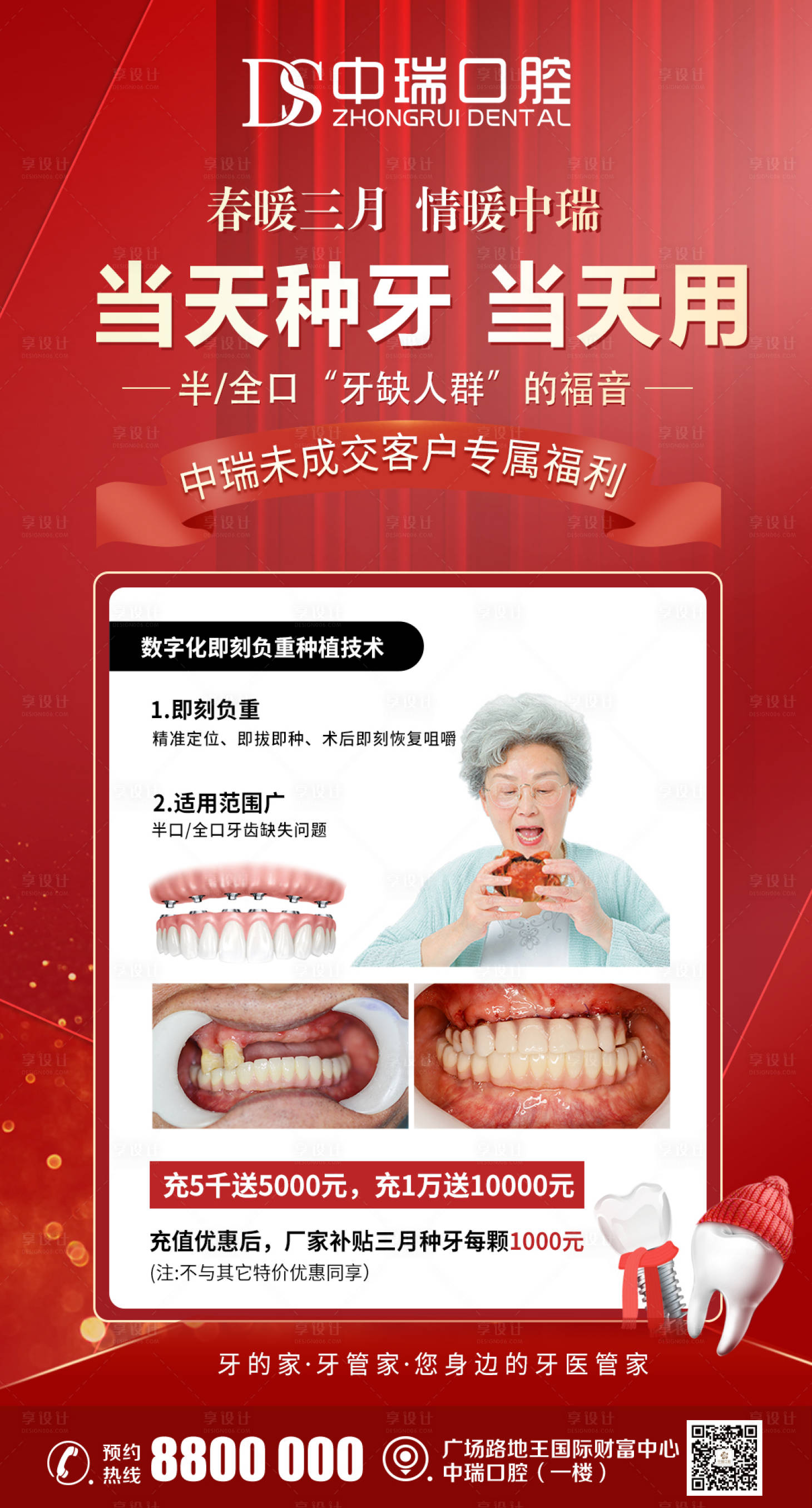 源文件下載【種植牙老客戶福利活動】編號：85740008814767498