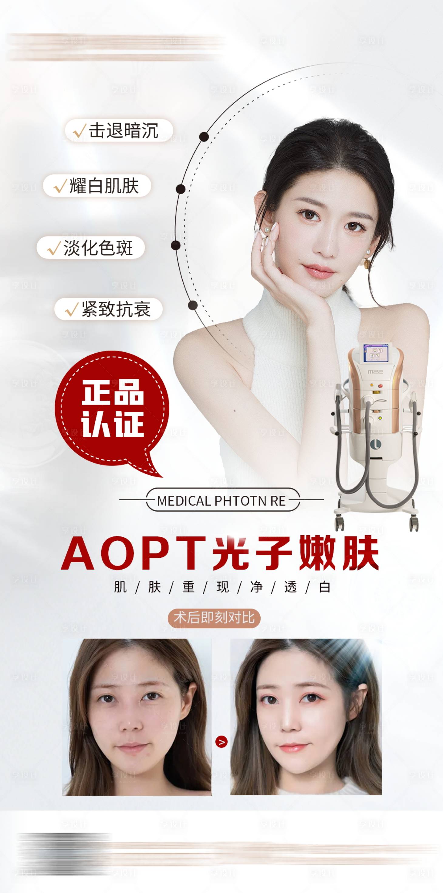 源文件下載【享設計】搜索編號：18860008705528183【醫美AOPT超光子嫩膚海報】