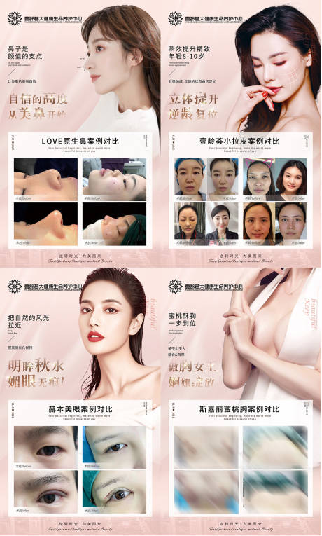 医美项目展板