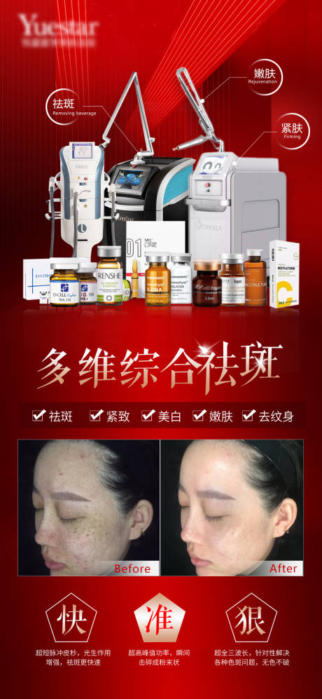 源文件下载【医美多维闪电祛斑海报】编号：26290008876321829