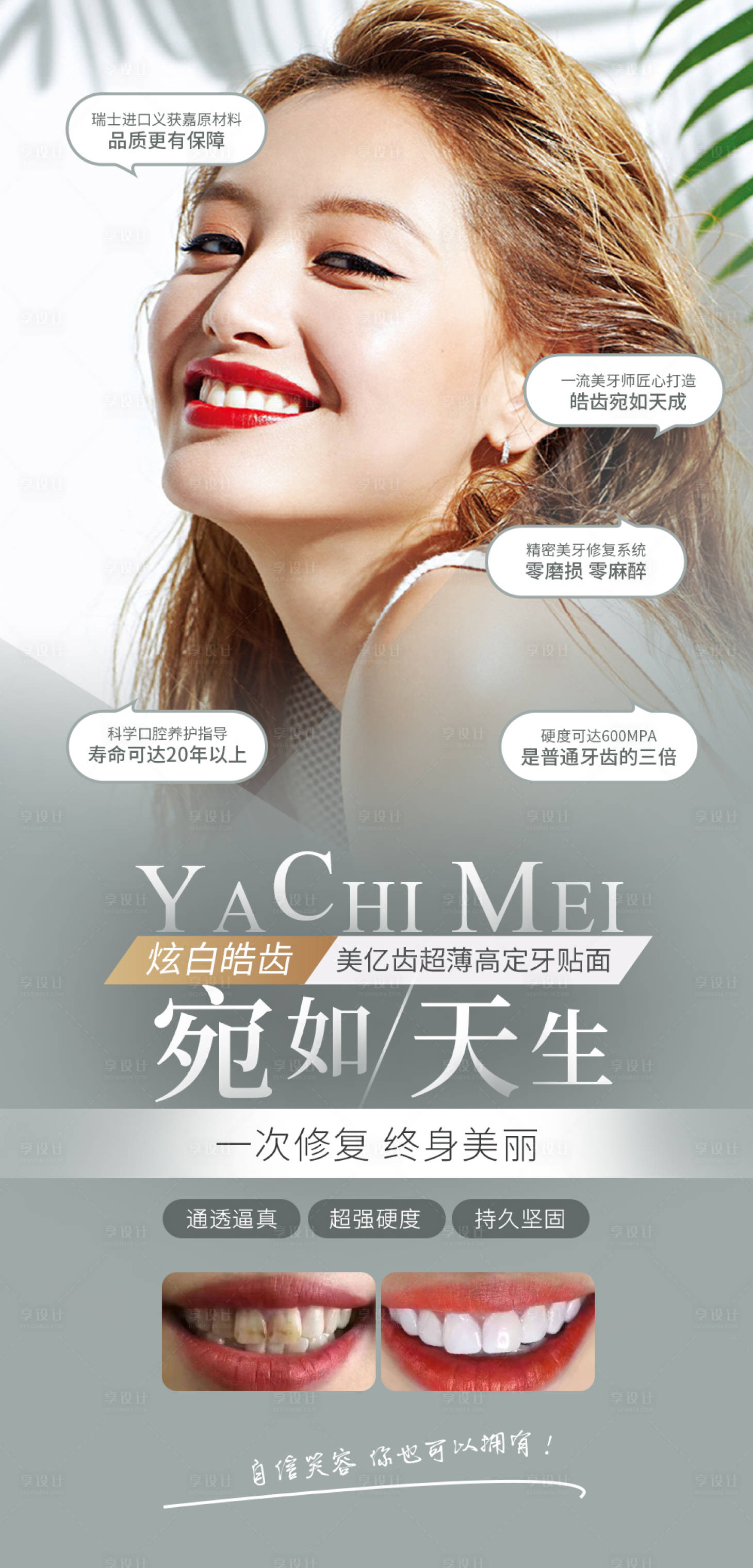 源文件下載【享設計】搜索編號：31550009054766637【瓷貼面牙齒美容海報】