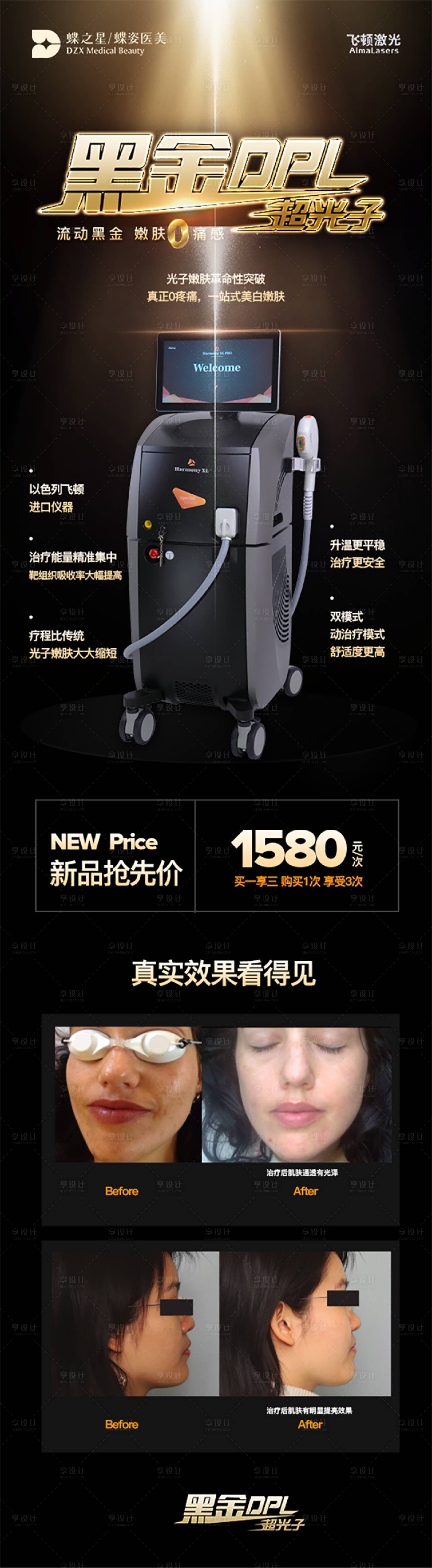 源文件下載【享設(shè)計】搜索編號：57700008761521167【醫(yī)美光子嫩膚黑金熱瑪吉超聲刀儀器海報】