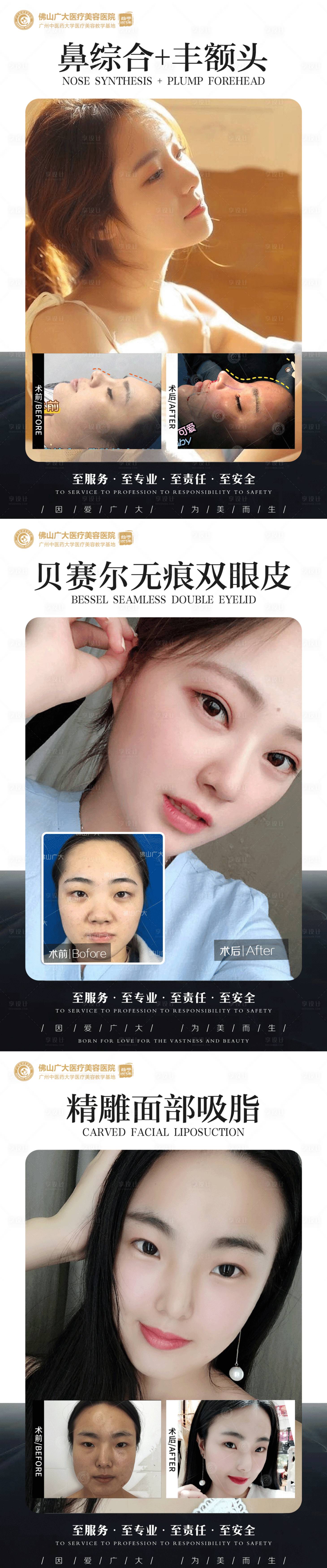 源文件下载【整形真人案例分享集】编号：92690009016425185