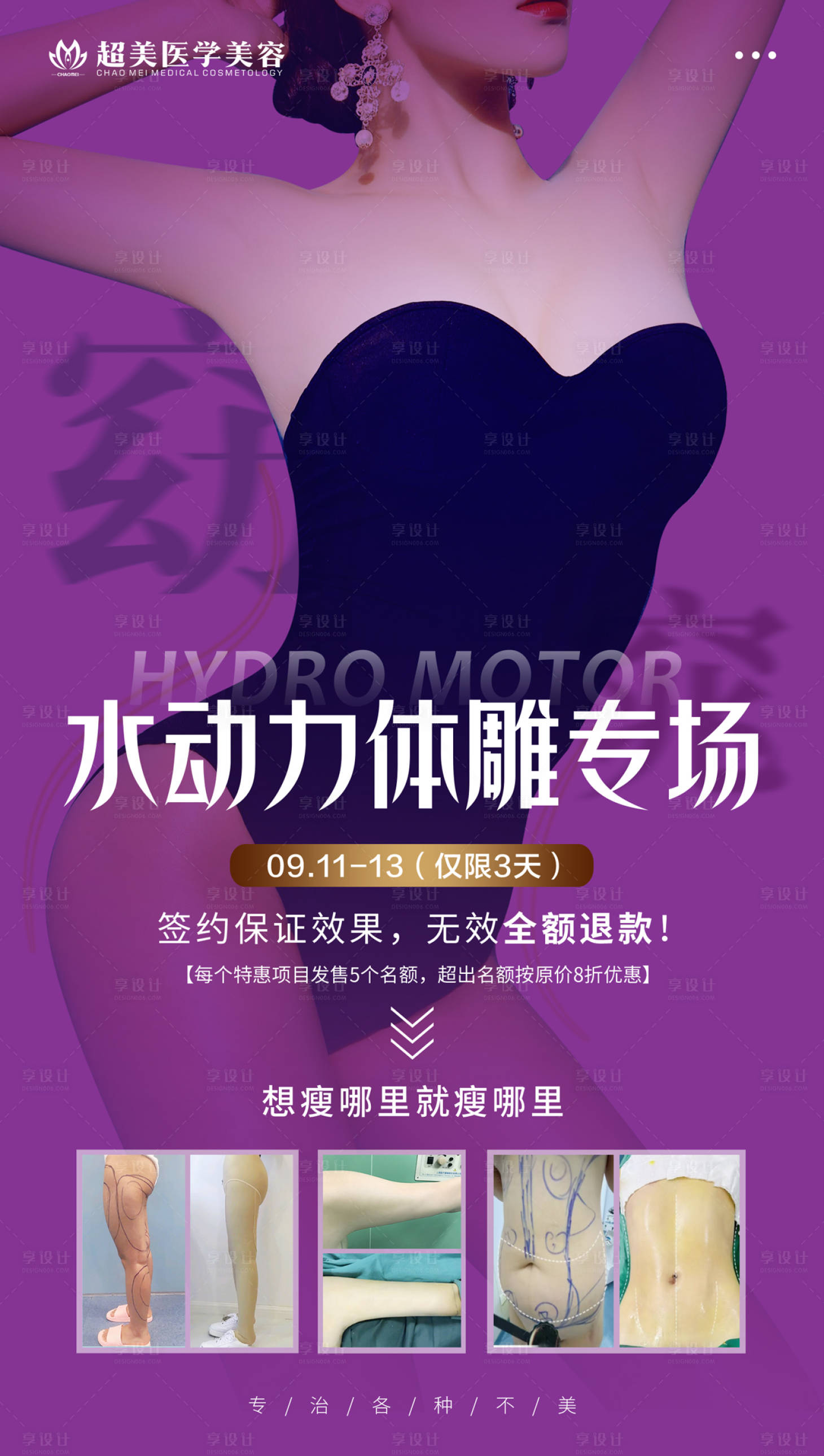 源文件下載【享設計】搜索編號：64810009006038648【醫美水動力吸脂專場】