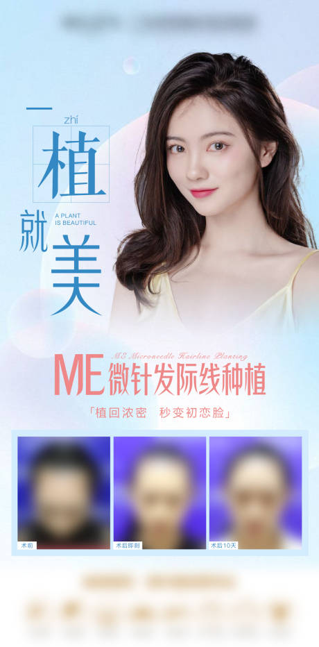 植发-源文件