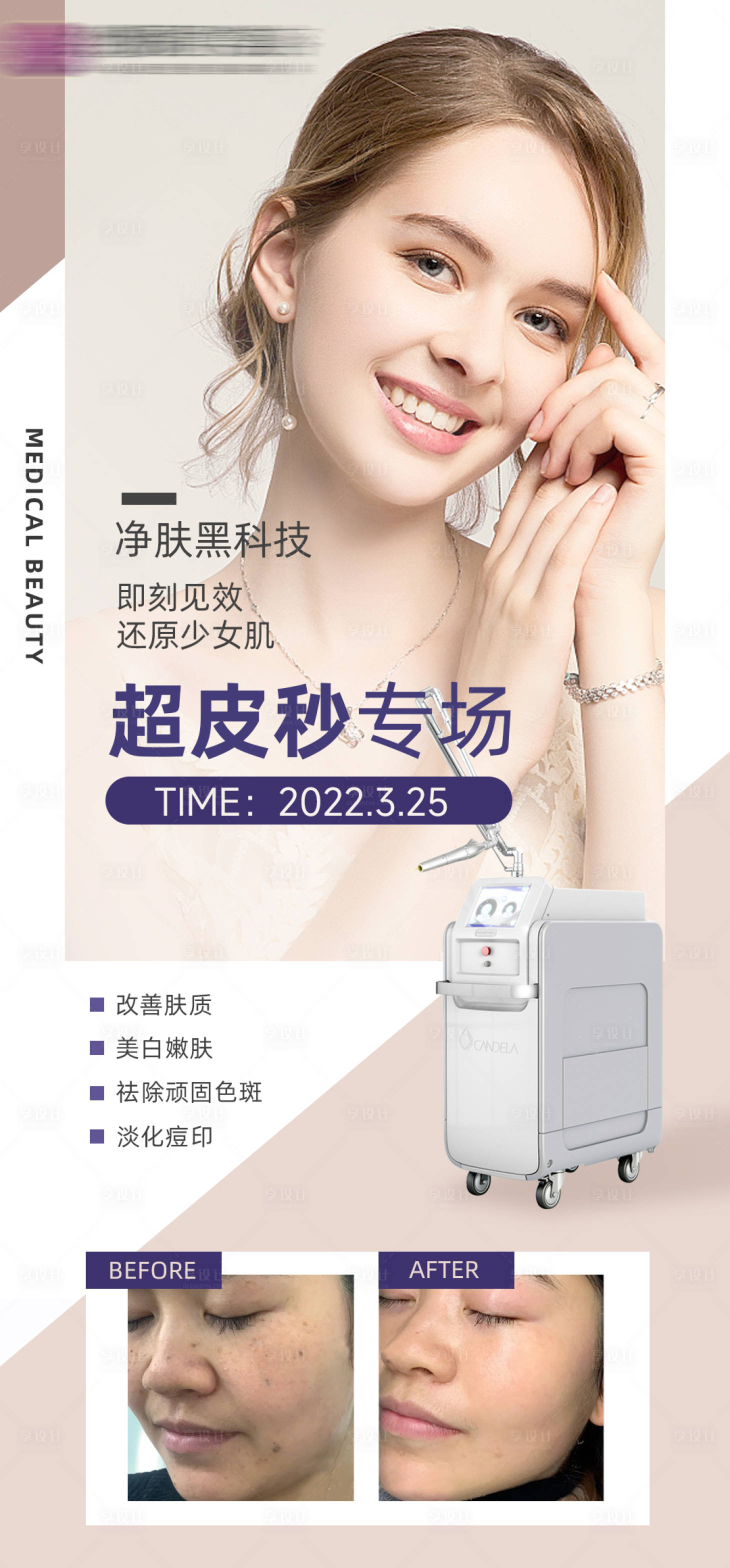 源文件下載【享設(shè)計】搜索編號：76120009091648165【醫(yī)美超皮秒海報】