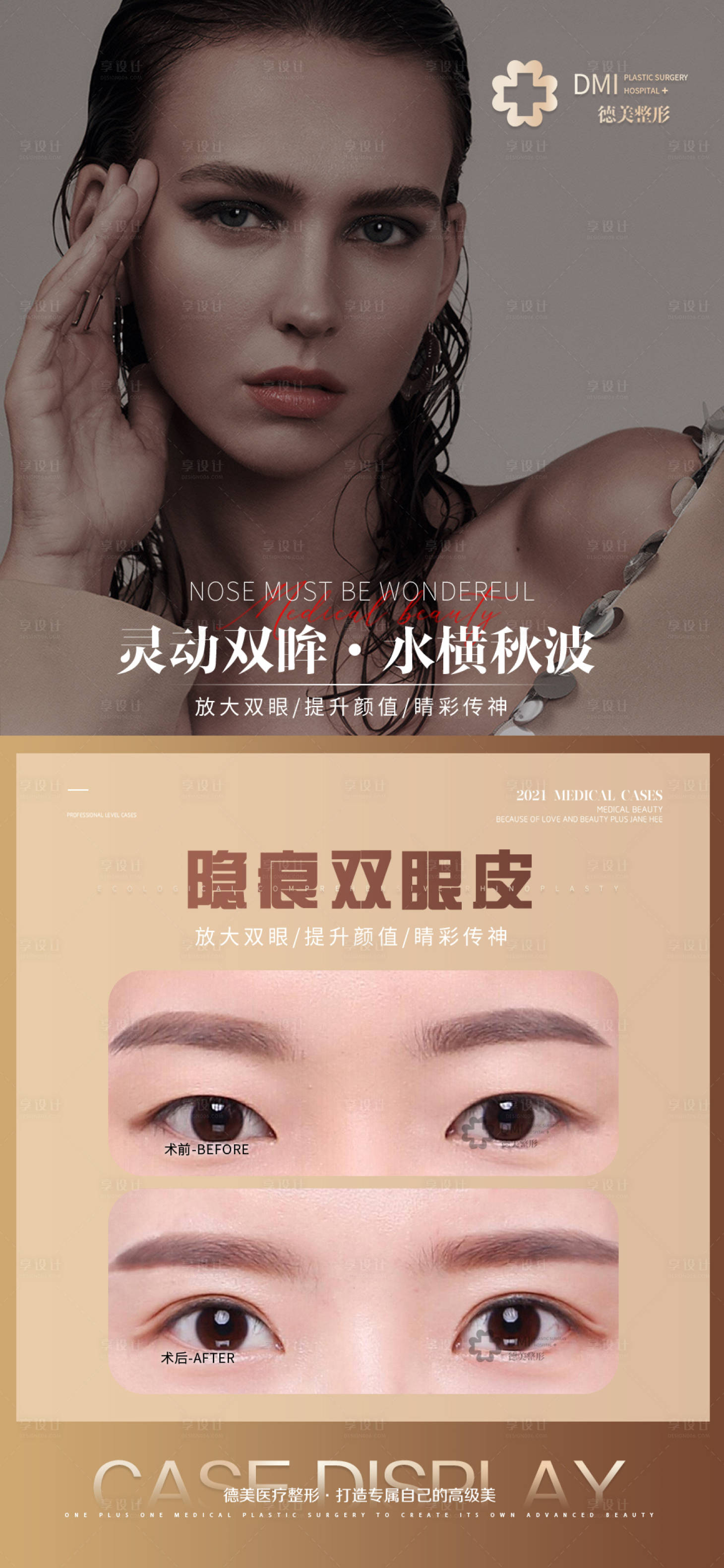 源文件下载【医美案例整形双眼皮线雕海报】编号：44260008674071989