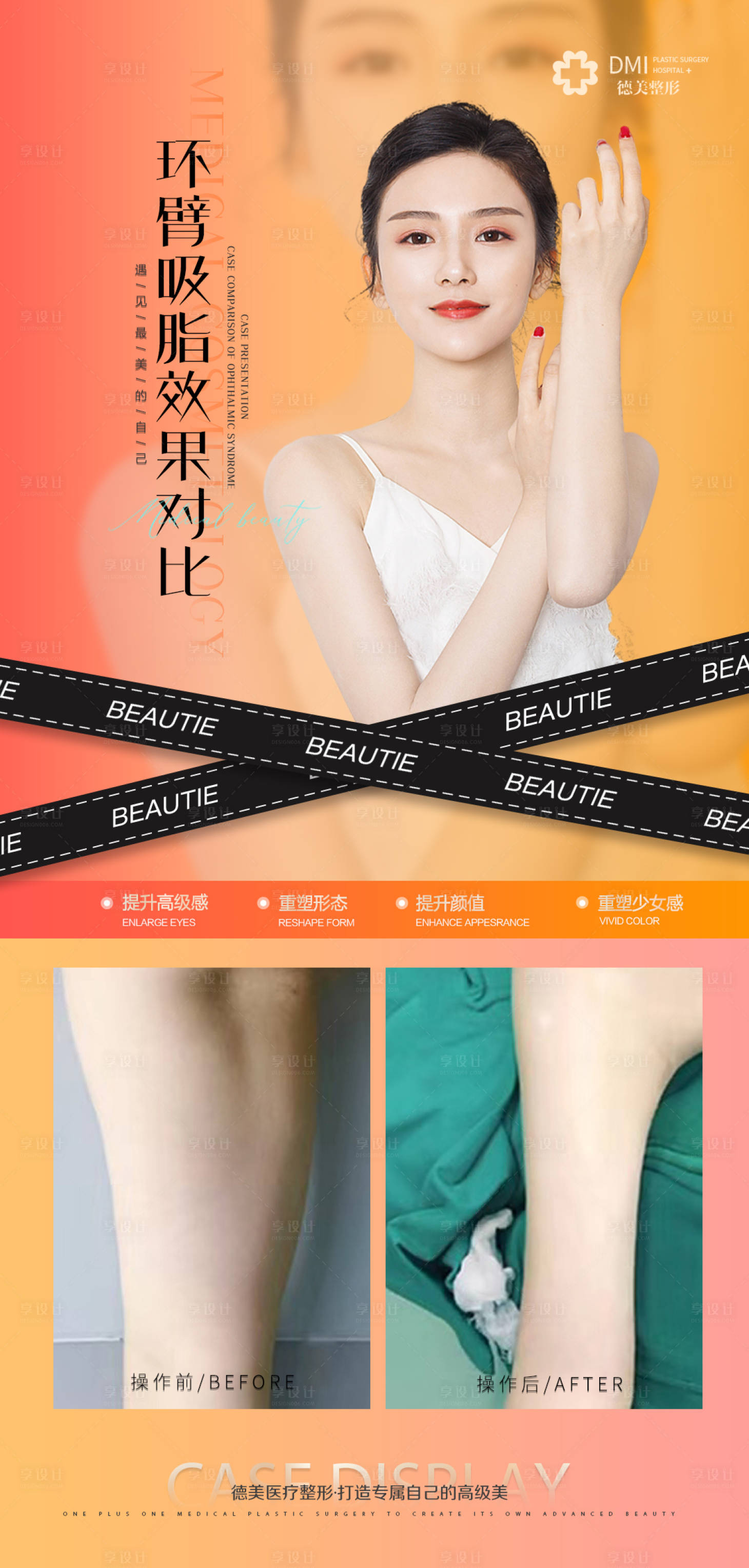 源文件下載【享設(shè)計(jì)】搜索編號：66150008734381167【醫(yī)美案例整形對比圖環(huán)臂吸脂海報(bào)】