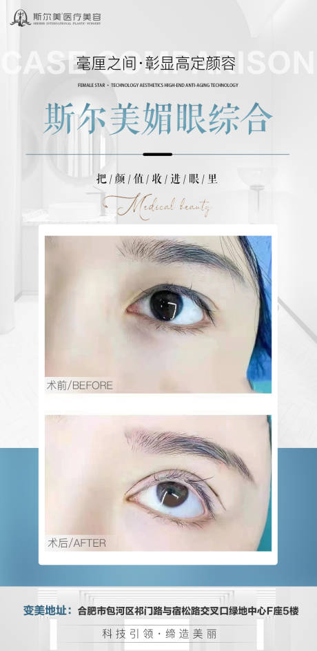 源文件下載【眼案例對比】編號：64160009136557747