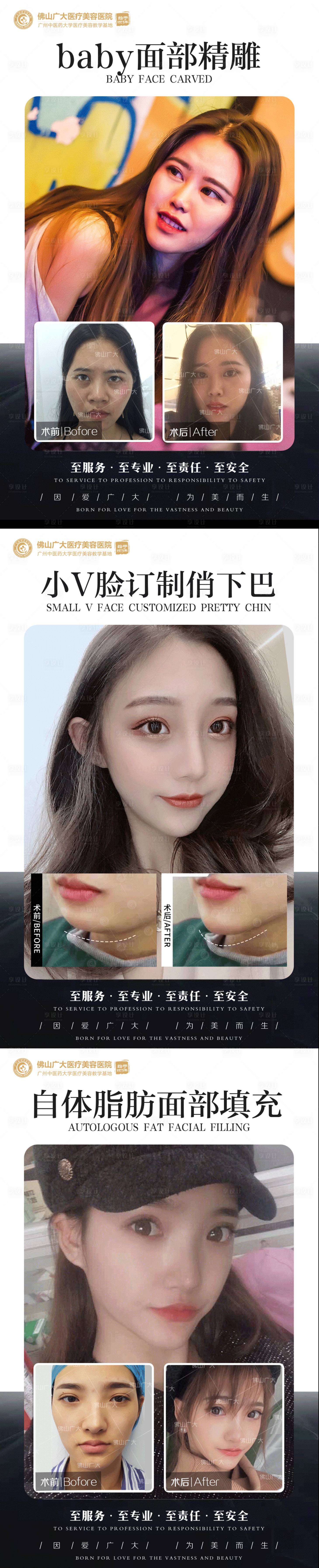 源文件下載【整形真人案例分享集】編號：23820009016099525