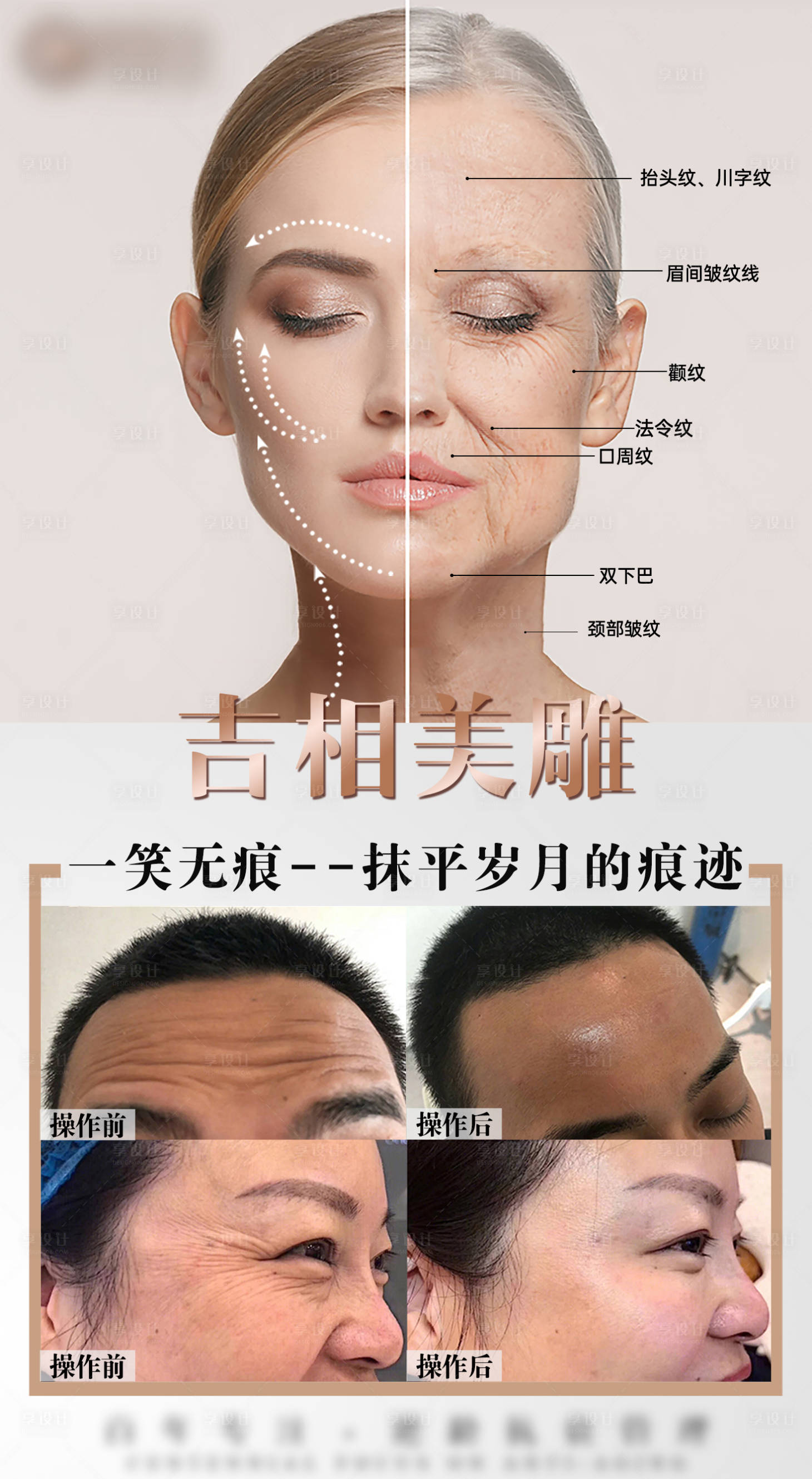 源文件下载【面雕医美海报】编号：34050009070581668