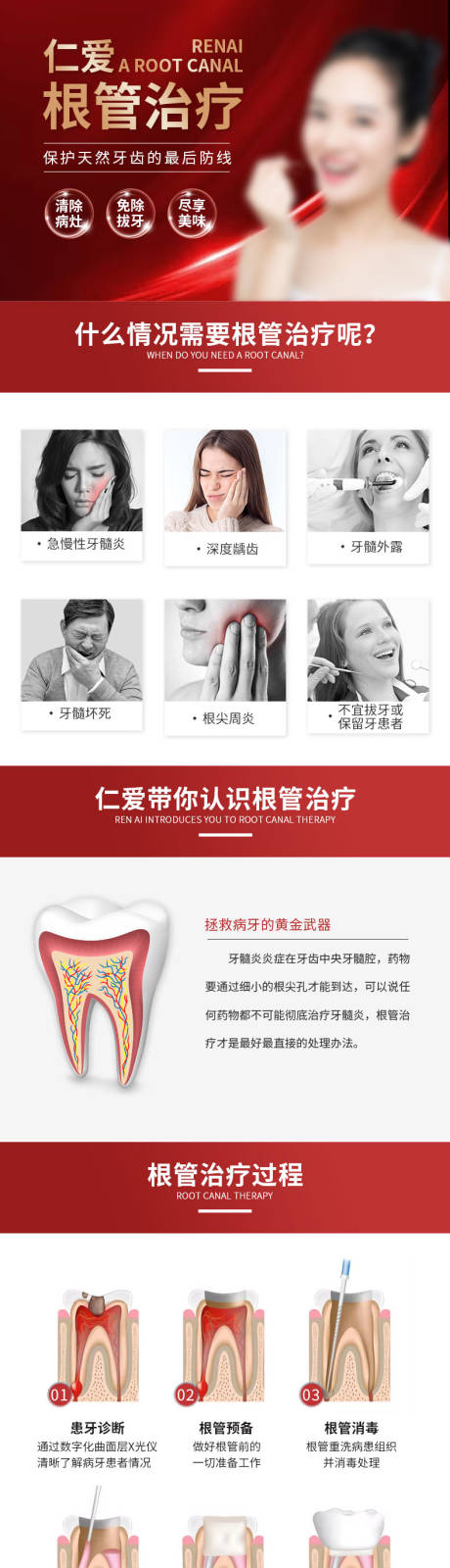 源文件下载【根管治疗】编号：91660008974122589