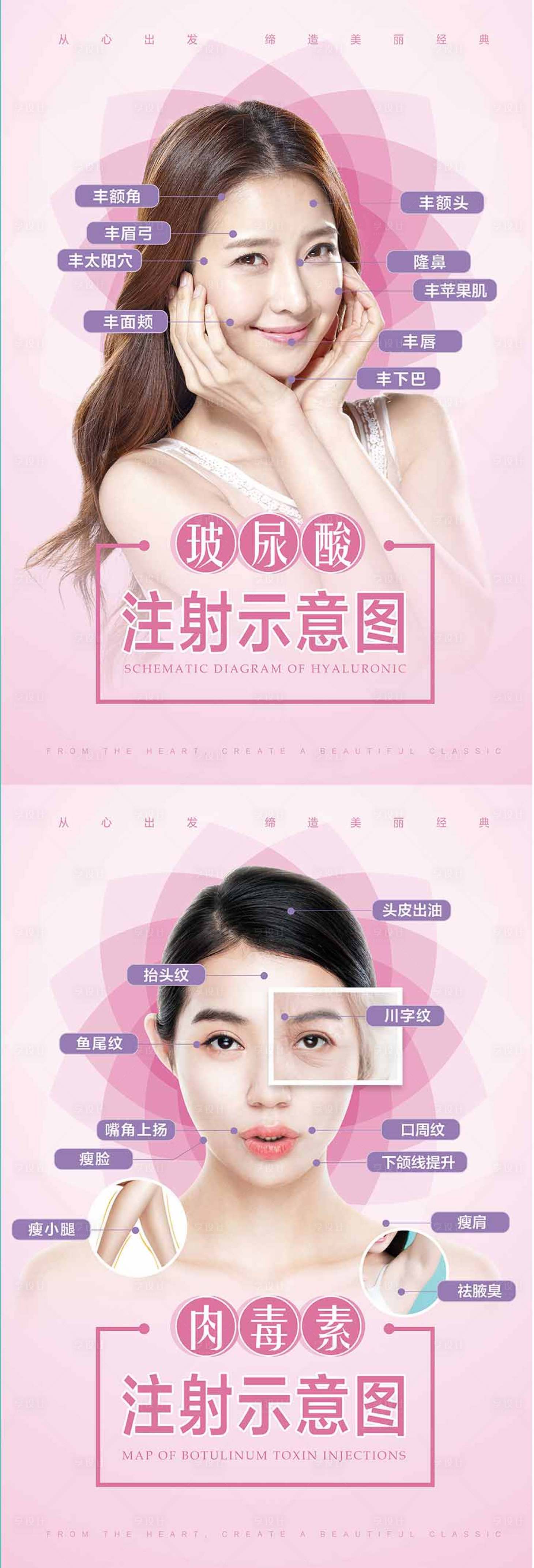 源文件下載【享設計】搜索編號：43190008768946764【醫美玻尿酸肉毒素注射部位圖展示海報】