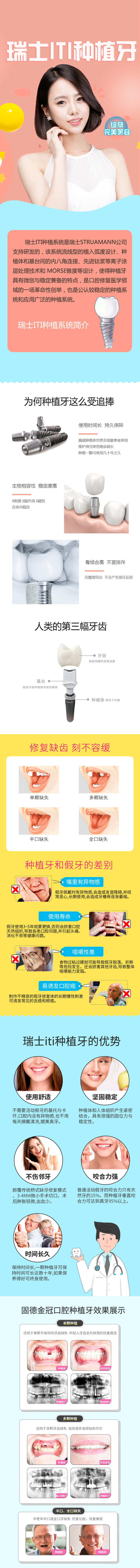 源文件下載【享設(shè)計】搜索編號：39120009073125192【瑞士ITI種植牙電商詳情】