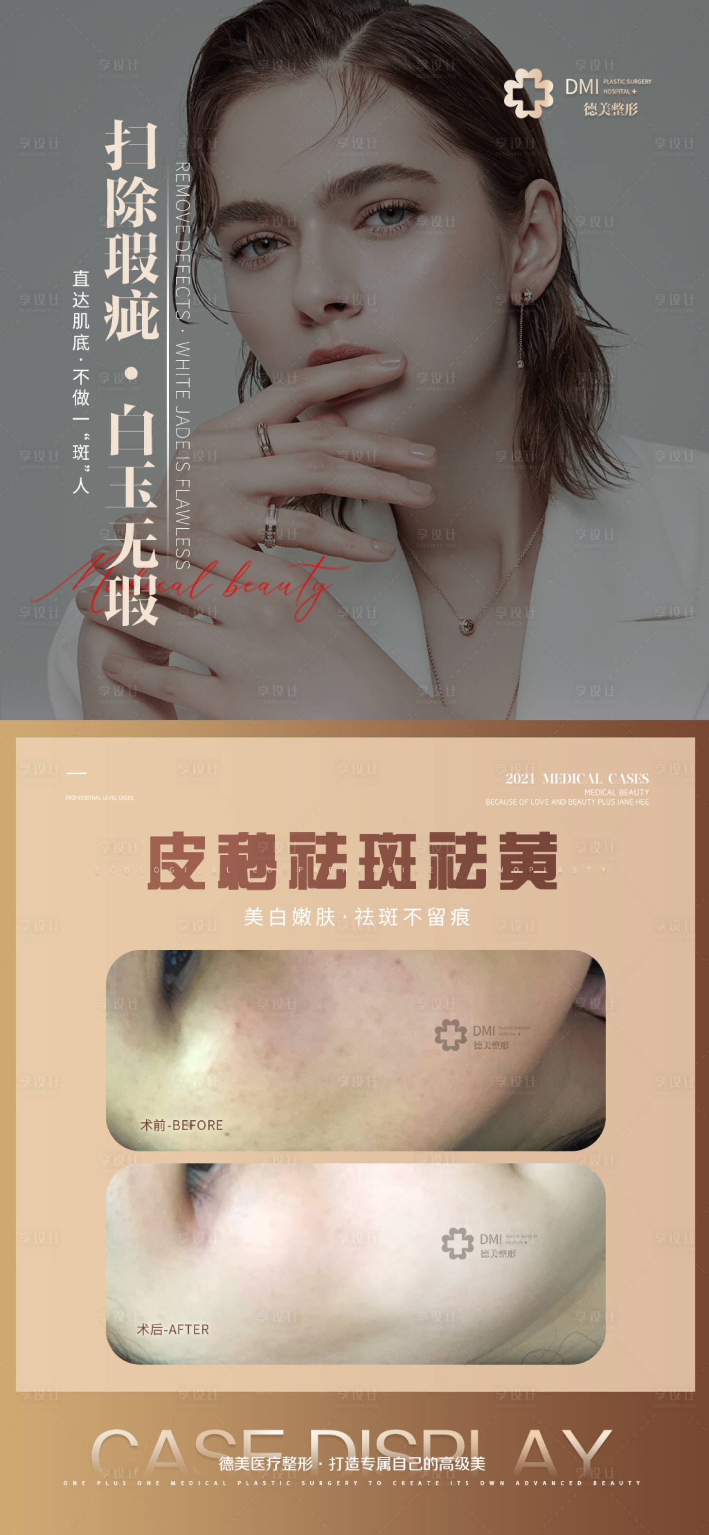 源文件下载【医美案例整形海报】编号：75510008734221084