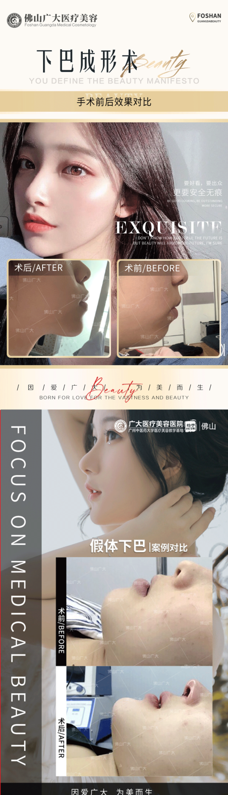 源文件下载【医美下巴整形案例集】编号：61200008991908717