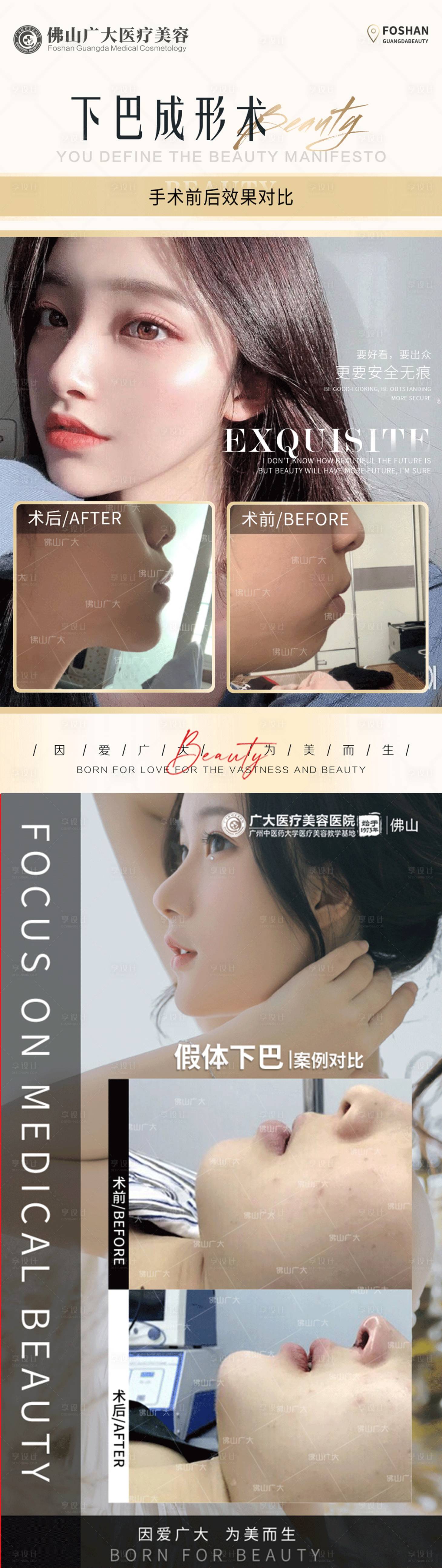 源文件下载【享设计】搜索编号：61200008991908717【医美下巴整形案例集】