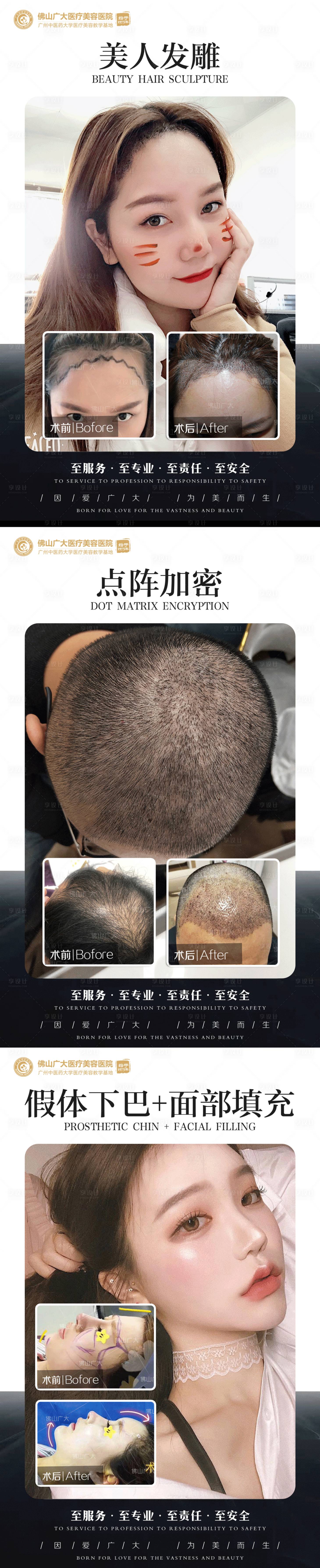 源文件下載【整形真人案例分享集】編號：60880009015836699