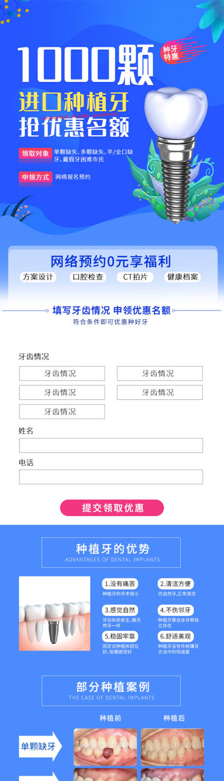 源文件下载【进口种植牙抢优惠名额详情页】编号：56010009076605063