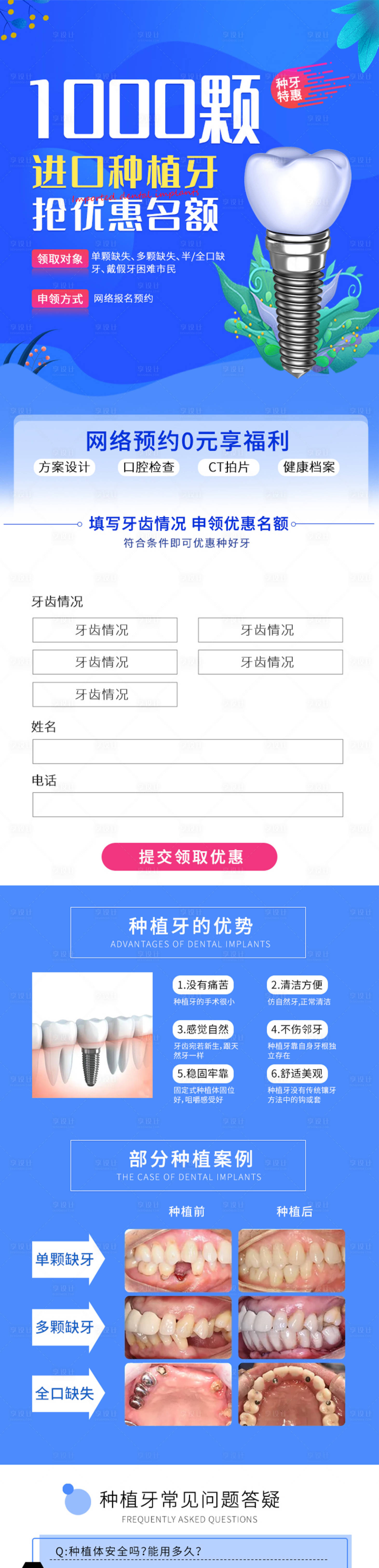 源文件下载【进口种植牙抢优惠名额详情页】编号：56010009076605063