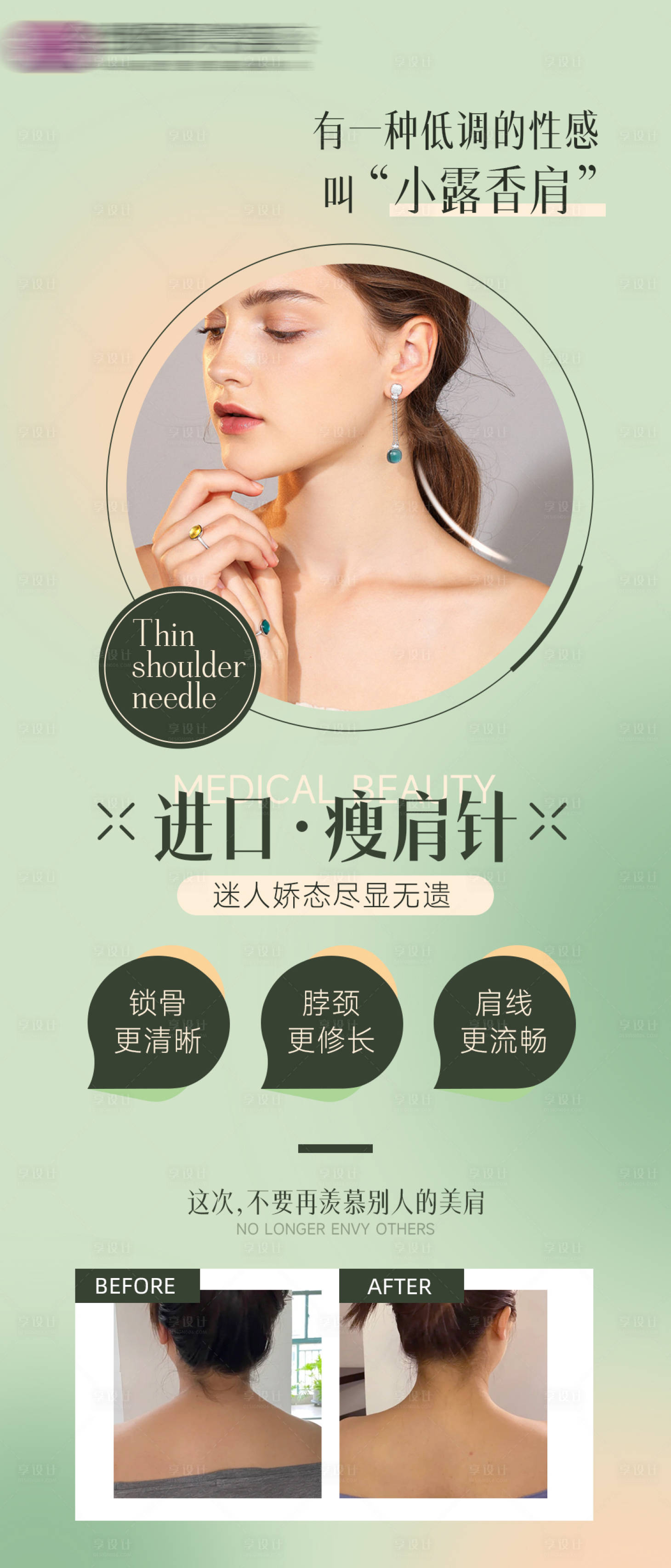 源文件下载【享设计】搜索编号：38750008953729474【医美进口瘦肩针海报】