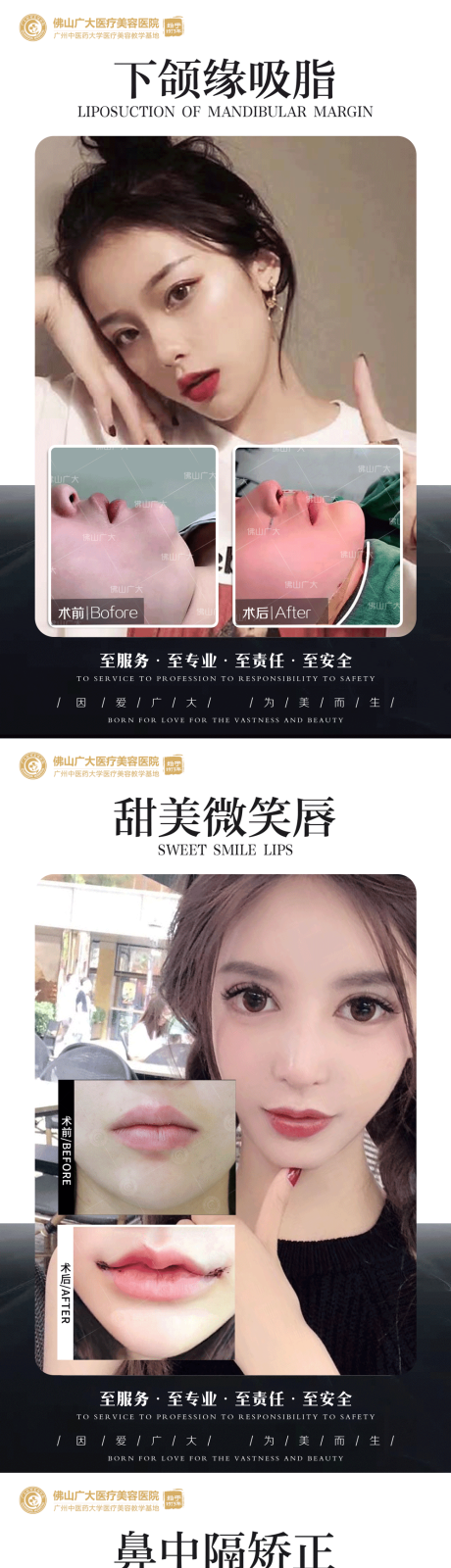源文件下载【整形真人案例分享集】编号：20220321095910720