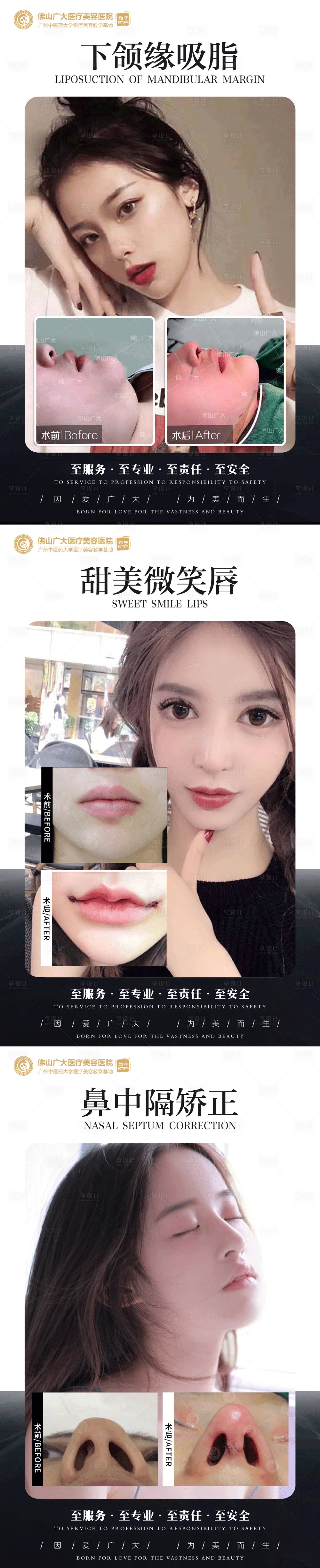源文件下載【享設計】搜索編號：53960009016511835【整形真人案例分享集】
