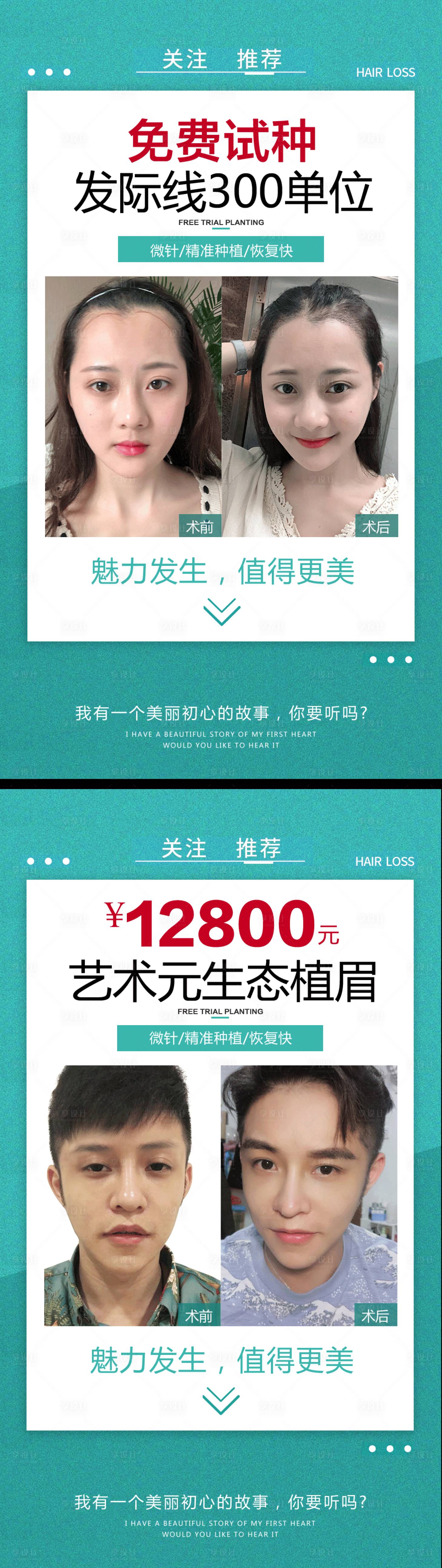 源文件下载【植发案例海报（TIF用PSD打开）】编号：52980008758866826
