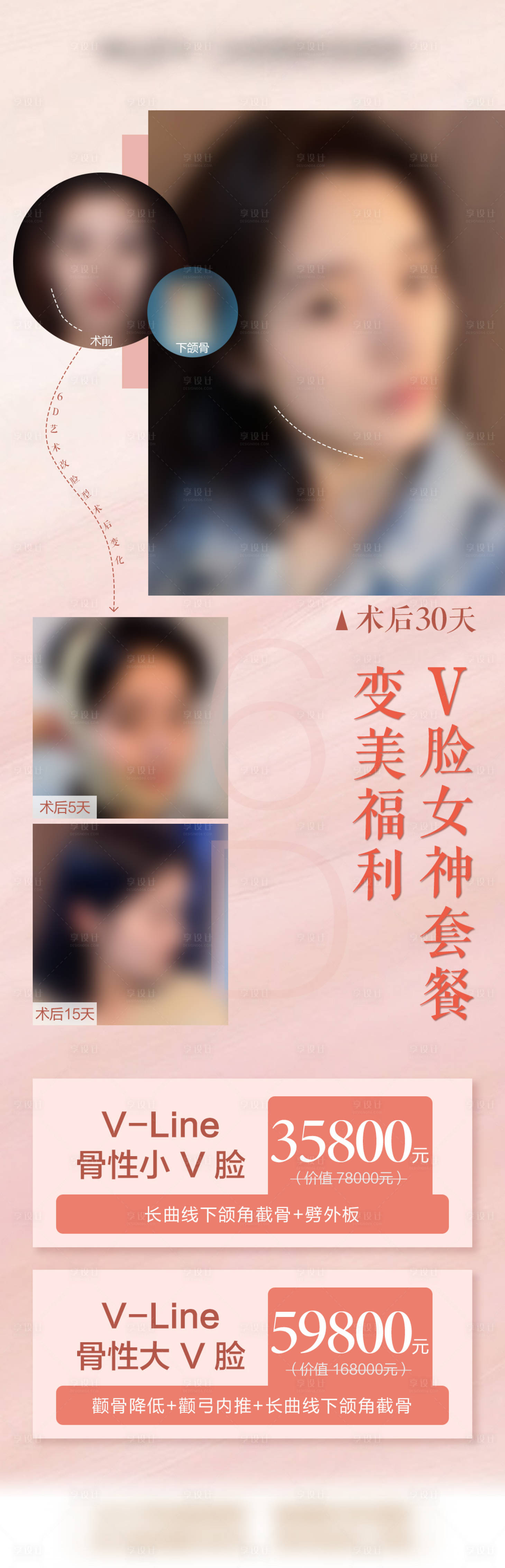 源文件下載【享設計】搜索編號：88520009070386361【醫美V臉案例】