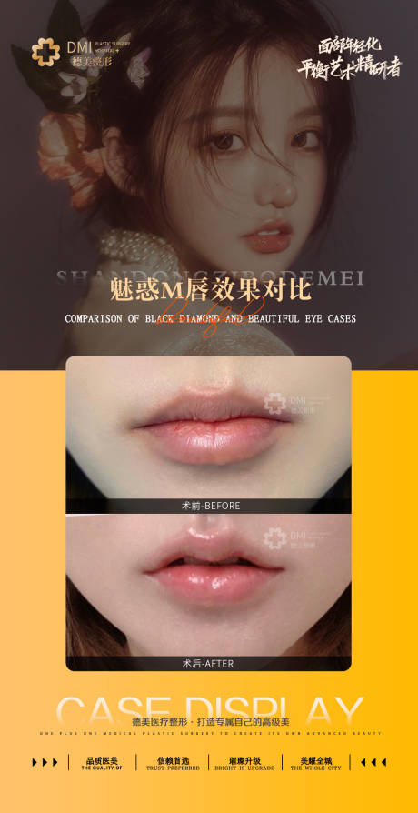 源文件下载【医美案例整形对比图M唇海报】编号：40240008734158614