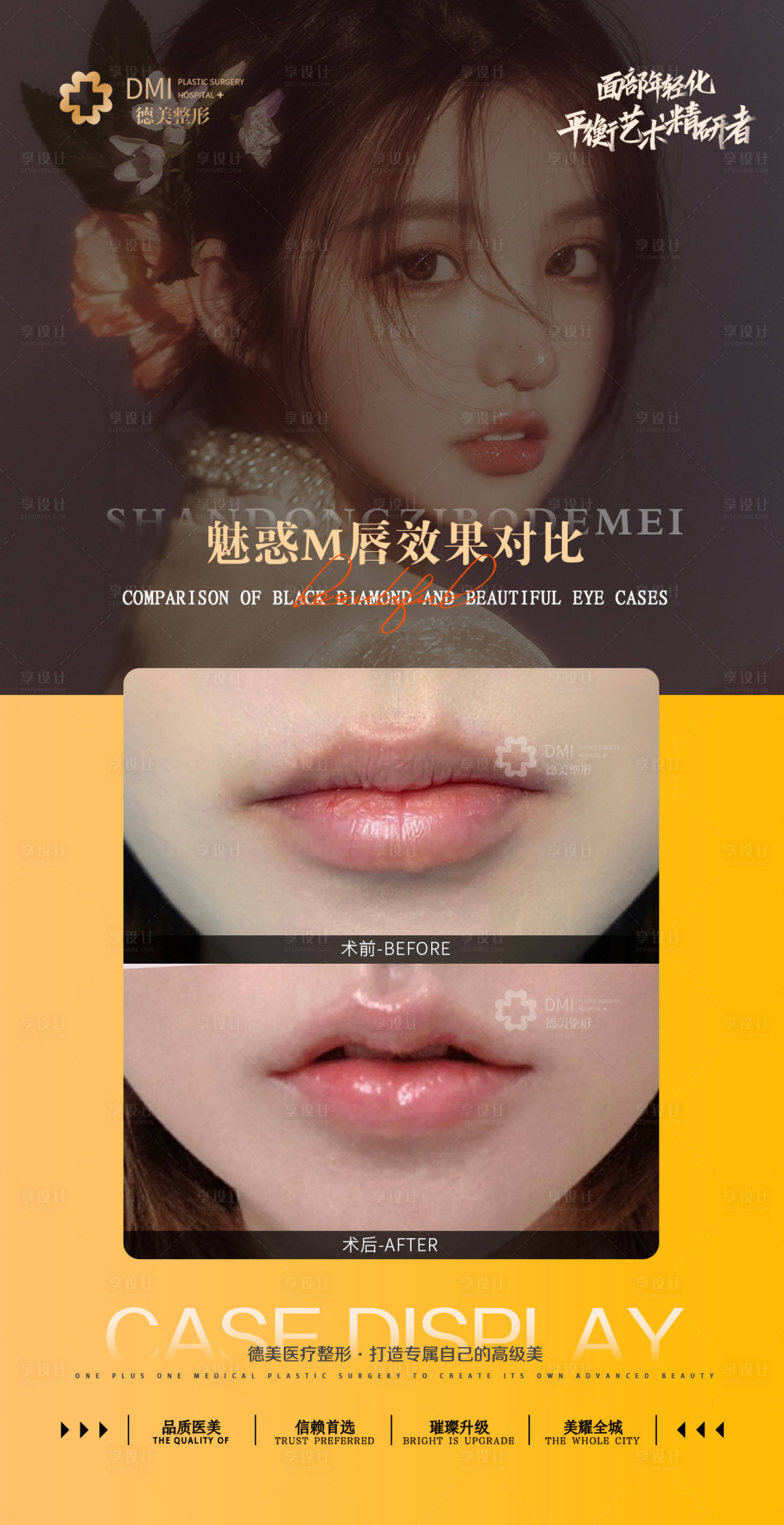 源文件下载【医美案例整形对比图M唇海报】编号：40240008734158614
