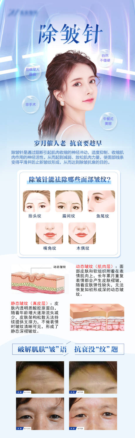 源文件下载【医美除皱针海报】编号：66090008780762049