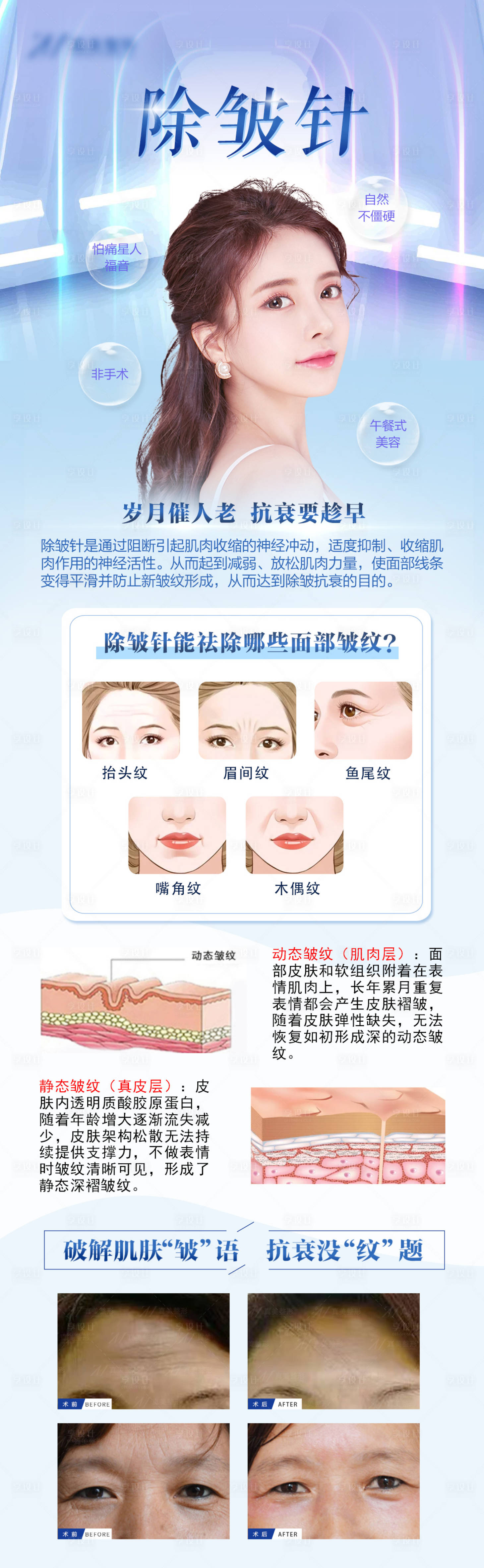 源文件下载【享设计】搜索编号：66090008780762049【医美除皱针海报】